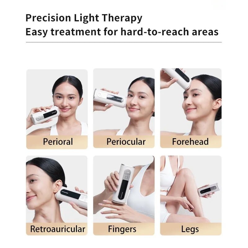 Wholesale oem Mini 308nm UV Phototherapy Device with OLED Display image 3