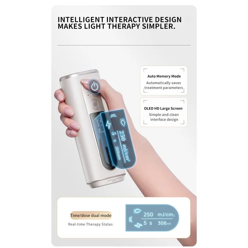 Wholesale oem Mini 308nm UV Phototherapy Device with OLED Display image 4